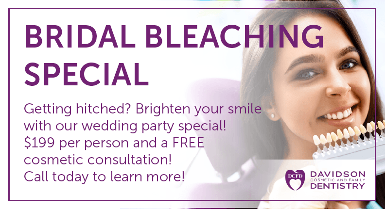 bridal bleaching special